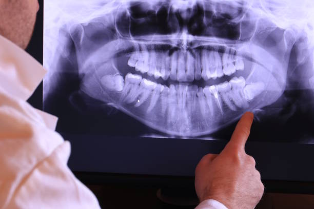 Best Emergency Dental Care for Trauma or Injury in Glyndon, MN