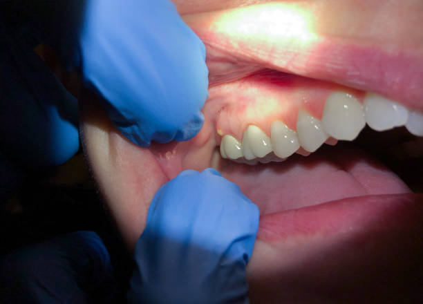 Best Emergency Dental Surgery in Glyndon, MN