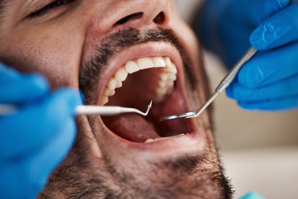 Best Weekend Emergency Dentist in Glyndon, MN